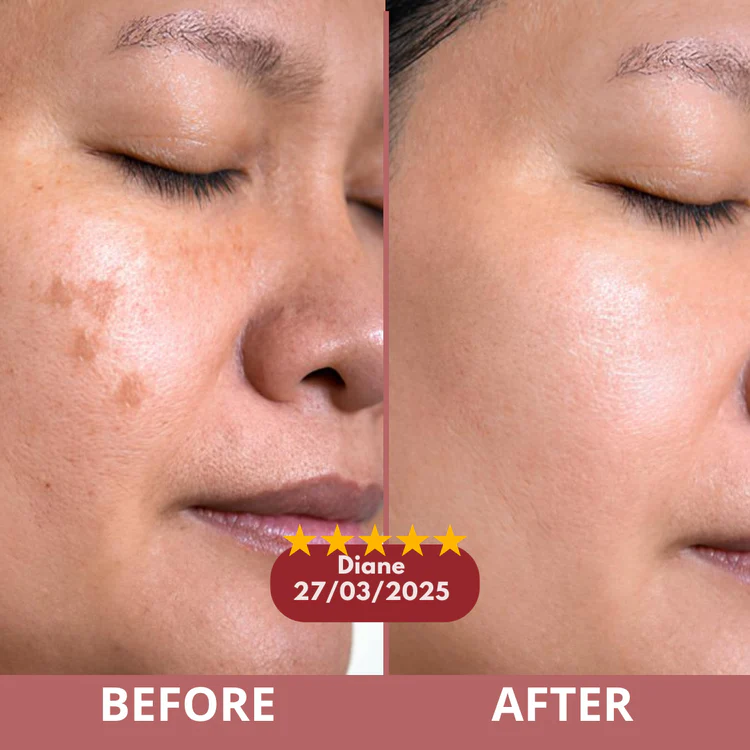 After using Calcium Volume Multi Balm